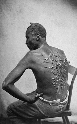 13th Amendment